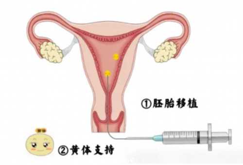 武汉三代试管生男孩费用解析与供卵助孕指南
