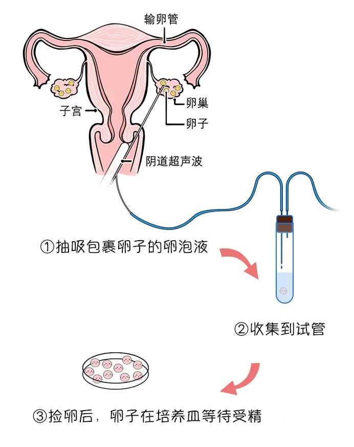 武汉供卵试管费用构成：检查、培养、保存与合同边界